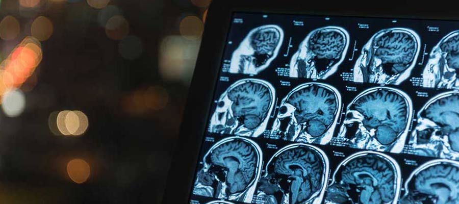MRI Courses in California