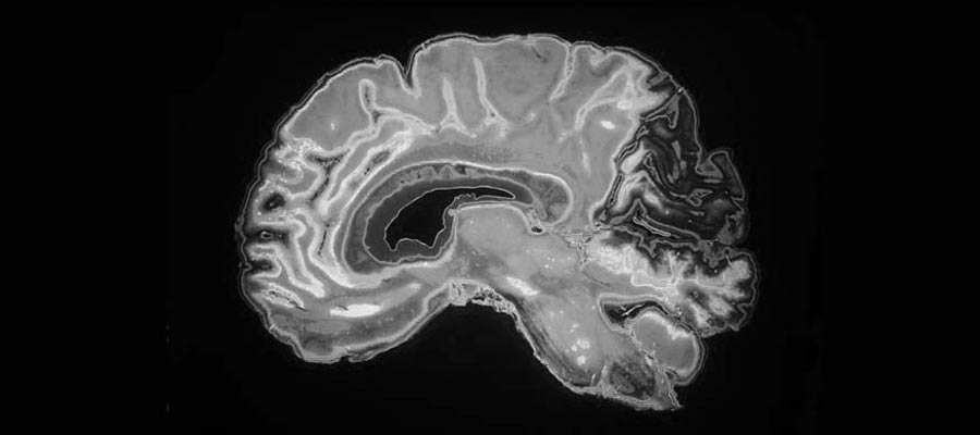 MRI Registry Review in My Area