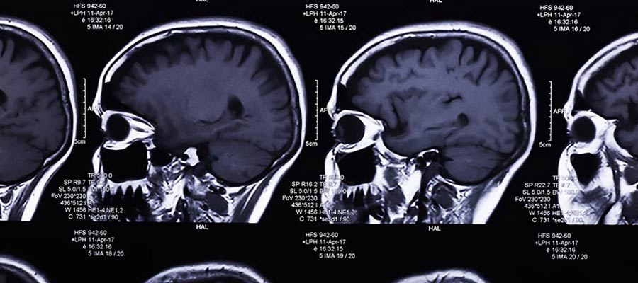 MRI Registry Review Texas