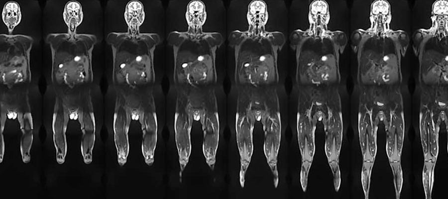 MRI Tech Salary California