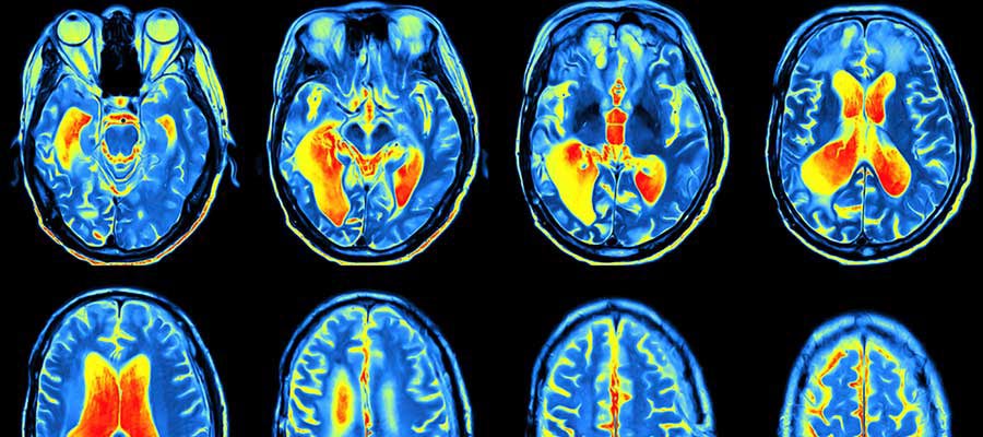 Best MRI Certification Programs