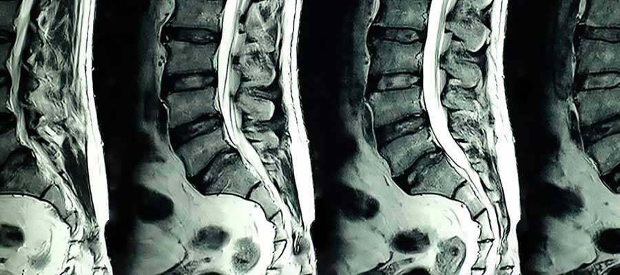 Cost of MRI Tech School Courses