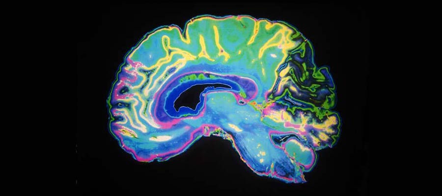 MRI Tech Salary