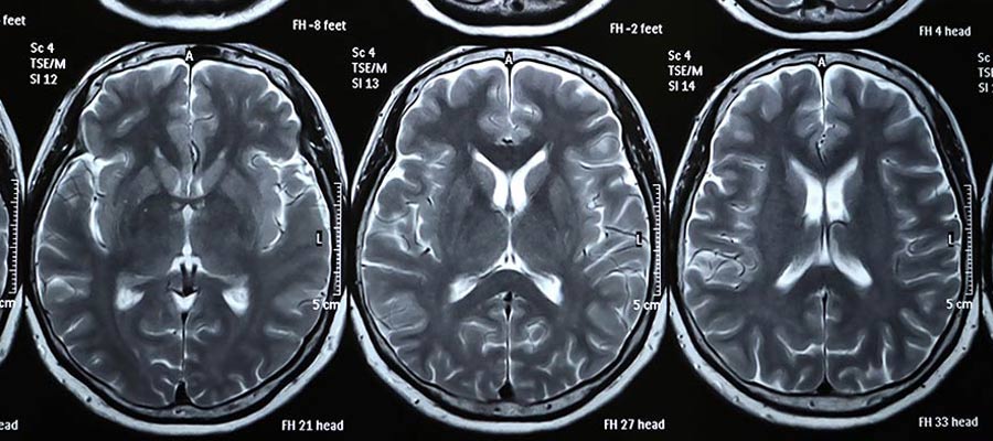 online MRI schools