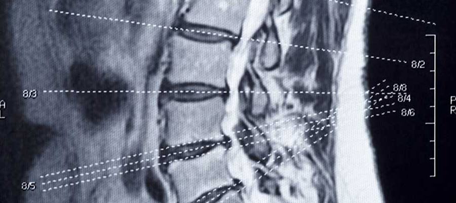 online MRI tech programs